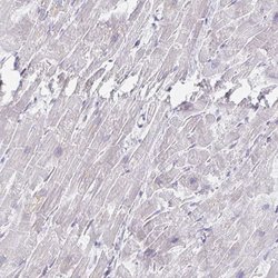 Invitrogen MYLK2 Polyclonal Antibody 100 &mu;L; Unconjugated:Antibodies,
