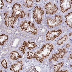 Invitrogen TP53I11 Polyclonal Antibody 100 &mu;L; Unconjugated:Antibodies,
