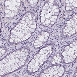 Invitrogen OR4A47 Polyclonal Antibody 100 &mu;L; Unconjugated:Antibodies,