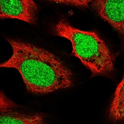 Invitrogen METTL17 Polyclonal Antibody 100 &mu;L; Unconjugated:Antibodies,