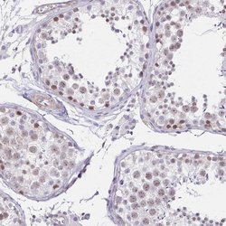 Invitrogen ANKRD62 Polyclonal Antibody 100 &mu;L; Unconjugated:Antibodies,