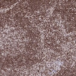 Invitrogen NIP7 Polyclonal Antibody 100 &mu;L; Unconjugated:Antibodies,