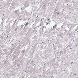 Invitrogen MYLK2 Polyclonal Antibody 100 &mu;L | Buy Online | Invitrogen&trade; | Fisher Scientific