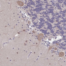 Invitrogen FEM1C Polyclonal Antibody 100 &mu;L; Unconjugated:Antibodies,
