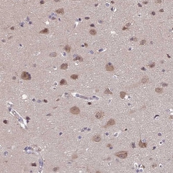 Invitrogen FEM1C Polyclonal Antibody 100 &mu;L; Unconjugated:Antibodies,