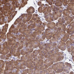 Invitrogen FEM1C Polyclonal Antibody 100 &mu;L; Unconjugated:Antibodies,