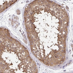 Invitrogen FEM1C Polyclonal Antibody 100 &mu;L; Unconjugated:Antibodies,