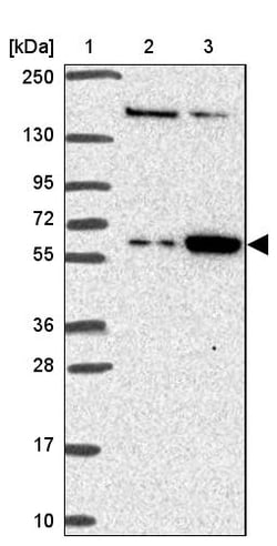 Invitrogen FEM1C Polyclonal Antibody 100 &mu;L; Unconjugated:Antibodies,