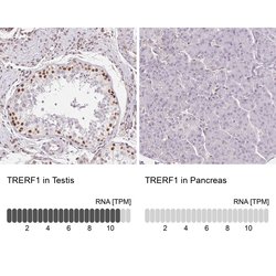Invitrogen TREF1 Polyclonal Antibody 100 &mu;L | Buy Online | Invitrogen&trade; | Fisher Scientific