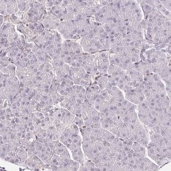 Invitrogen TREF1 Polyclonal Antibody 100 &mu;L | Buy Online | Invitrogen&trade; | Fisher Scientific