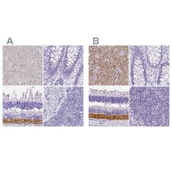Invitrogen VGAT Polyclonal Antibody 100 &mu;L; Unconjugated:Antibodies,