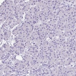 Invitrogen VGAT Polyclonal Antibody 100 &mu;L; Unconjugated:Antibodies,