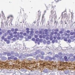 Invitrogen VGAT Polyclonal Antibody 100 &mu;L; Unconjugated:Antibodies,