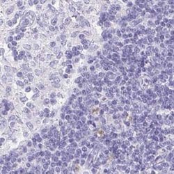 Invitrogen VGAT Polyclonal Antibody 100 &mu;L; Unconjugated:Antibodies,