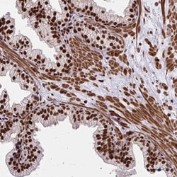 Invitrogen TBL1Y Polyclonal Antibody 100 &mu;L; Unconjugated:Antibodies,