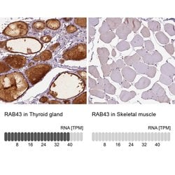Invitrogen RAB43 Polyclonal Antibody 100 &mu;L | Buy Online | Invitrogen&trade; | Fisher Scientific