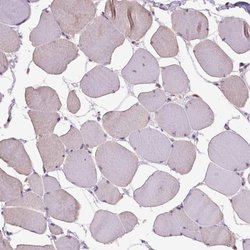 Invitrogen RAB43 Polyclonal Antibody 100 &mu;L | Buy Online | Invitrogen&trade; | Fisher Scientific
