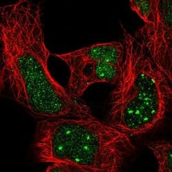 Invitrogen HOXA4 Polyclonal Antibody 100 &mu;L; Unconjugated:Antibodies,