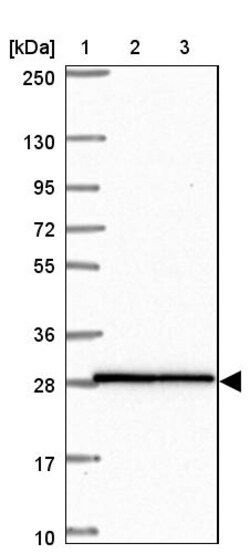 Invitrogen HOXA4 Polyclonal Antibody 100 &mu;L | Buy Online | Invitrogen&trade; | Fisher Scientific