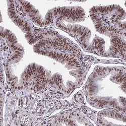 Invitrogen HOXA4 Polyclonal Antibody 100 &mu;L; Unconjugated:Antibodies,