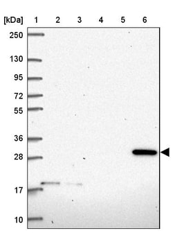 Invitrogen CLIC2 Polyclonal Antibody 100 &mu;L; Unconjugated:Antibodies,