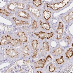 Invitrogen SAA4 Polyclonal Antibody 100 &mu;L; Unconjugated:Antibodies,