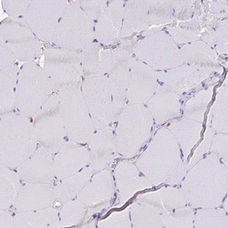 Invitrogen MYO1B Polyclonal Antibody 100 &mu;L; Unconjugated:Antibodies,
