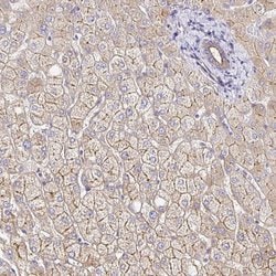 Invitrogen MYO1B Polyclonal Antibody 100 &mu;L; Unconjugated:Antibodies,