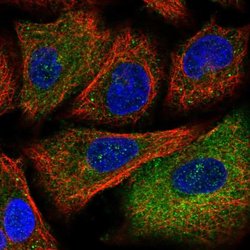 Invitrogen PITPNM1 Polyclonal Antibody 100 &mu;L; Unconjugated:Antibodies,