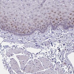 Invitrogen ZNF554 Polyclonal Antibody 100 &mu;L; Unconjugated:Antibodies,