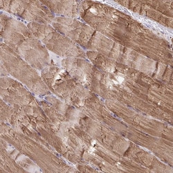 Invitrogen KLHL34 Polyclonal Antibody 100 &mu;L; Unconjugated:Antibodies,