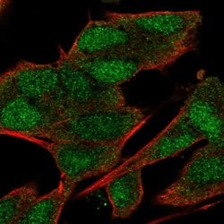 Invitrogen C20orf132 Polyclonal Antibody 100 &mu;L; Unconjugated:Antibodies,