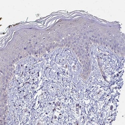 Invitrogen IFI44L Polyclonal Antibody 100 &mu;L; Unconjugated:Antibodies,