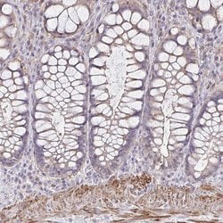 Invitrogen IFI44L Polyclonal Antibody 100 &mu;L; Unconjugated:Antibodies,