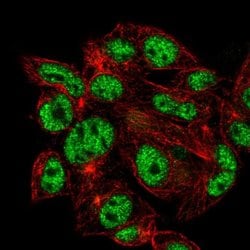 Invitrogen VSIG10L Polyclonal Antibody 100 &mu;L; Unconjugated:Antibodies,
