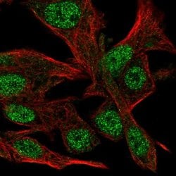 CLASRP Polyclonal Antibody:Antibodies, Polyclonal