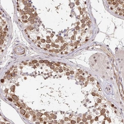 CLASRP Polyclonal Antibody:Antibodies, Polyclonal