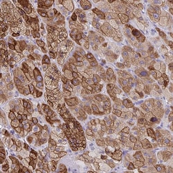 Invitrogen ZFP82 Polyclonal Antibody 100 &mu;L; Unconjugated:Antibodies,