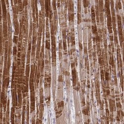 MP68 Polyclonal Antibody:Antibodies, Polyclonal