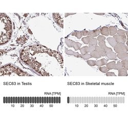 Invitrogen SEC63 Polyclonal Antibody 100 &mu;L; Unconjugated:Antibodies,