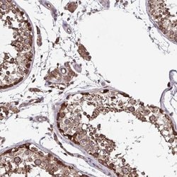 Invitrogen SEC63 Polyclonal Antibody 100 &mu;L; Unconjugated:Antibodies,