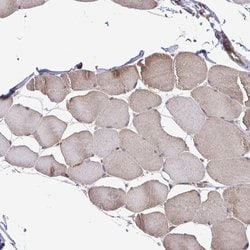 Invitrogen SEC63 Polyclonal Antibody 100 &mu;L; Unconjugated:Antibodies,