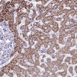 Invitrogen ANKRD60 Polyclonal Antibody 100 &mu;L; Unconjugated:Antibodies,