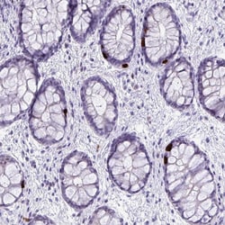 Invitrogen LCN15 Polyclonal Antibody 100 &mu;L; Unconjugated:Antibodies,