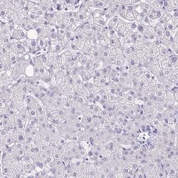 Invitrogen LCN15 Polyclonal Antibody 100 &mu;L; Unconjugated:Antibodies,