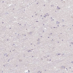 LPA Polyclonal Antibody:Antibodies, Polyclonal