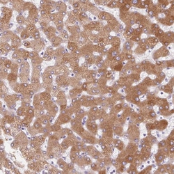 LPA Polyclonal Antibody:Antibodies, Polyclonal