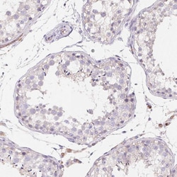 LPA Polyclonal Antibody:Antibodies, Polyclonal