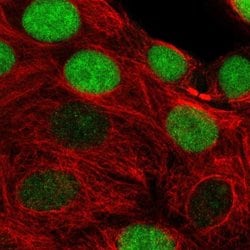 TIMELESS Polyclonal Antibody:Antibodies, Polyclonal