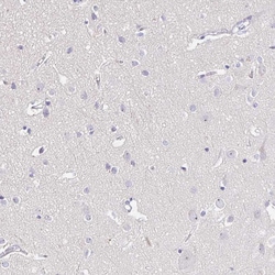 TIMELESS Polyclonal Antibody:Antibodies, Polyclonal